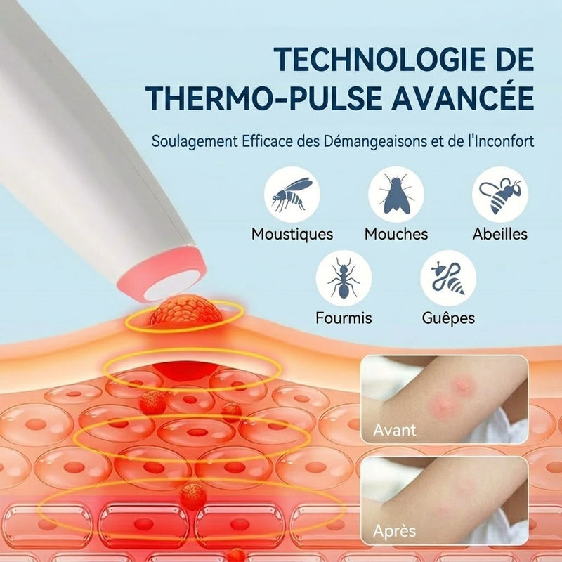 BugyHeat Appareil Soulageant Les Piqûres D'Insectes