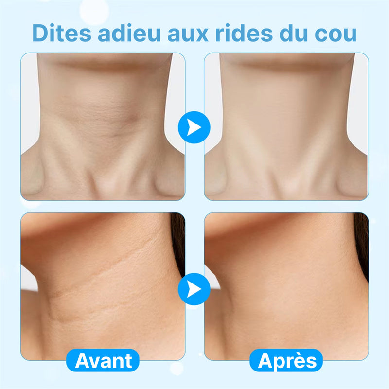 Feicemat V2 Appareil Lifting Visage